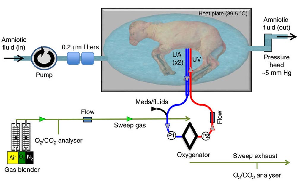 artificial-womb-2